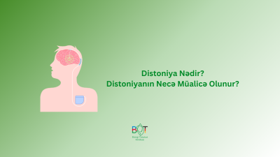 Distoniya Nədir? Distoniyanın Necə Müalicə Olunur?
