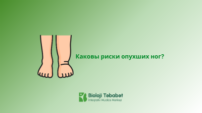 Каковы риски опухших ног?