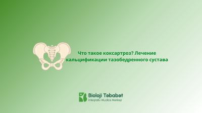 Что такое коксартроз? Лечение кальцификации тазобедренного сустава