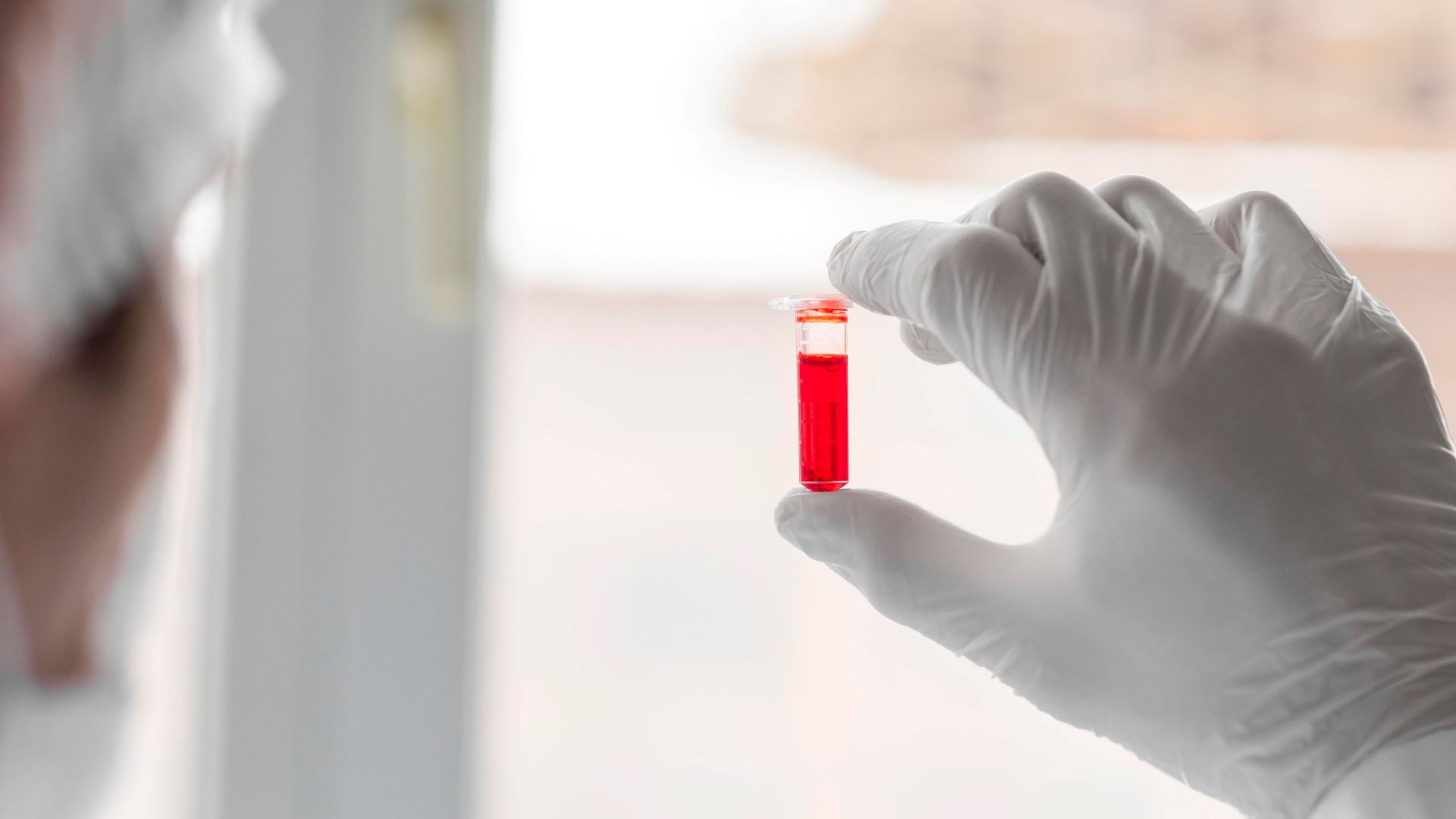 Qan Artıran Qidalar: Anemiya ilə Mübarizə və Effektiv Müalicə Yolları