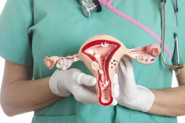 Mioma Nədir? Mioma Niyə Yaranır? Mioma Elametleri, Müalicə