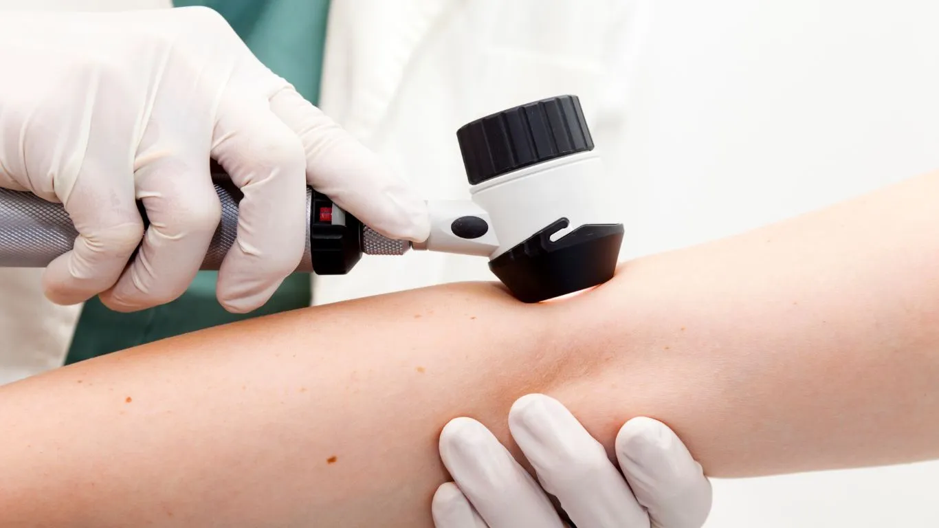 Dermatoveneroloq Nədir? Bakıda Ən Yaxşı Dermatoveneroloq